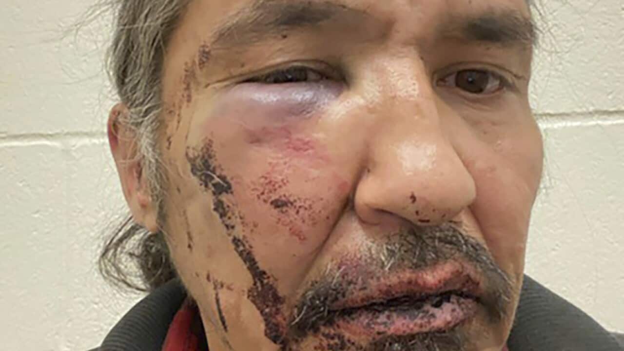 Athabasca Chipewayan Chief Allan Adam is calling for the government to investigate after he alleges RCMP assaulted him during an arrest.