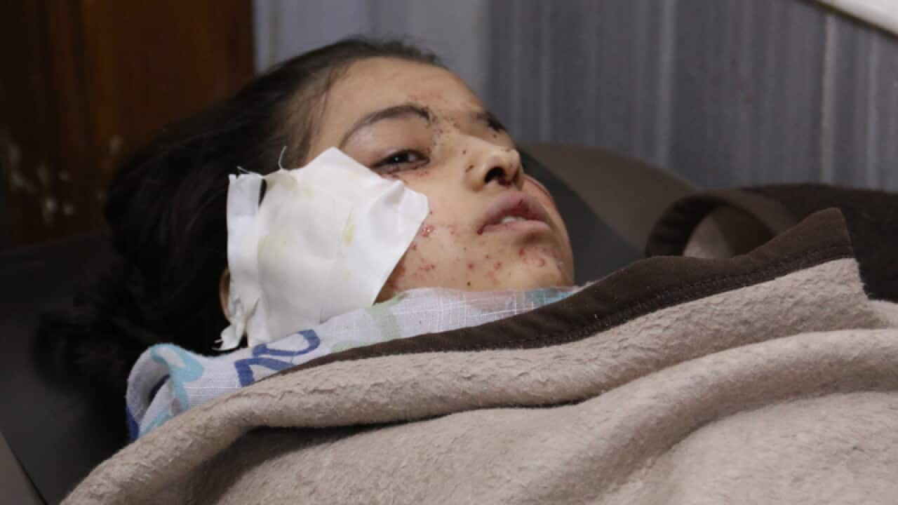 A young Syrian girl lays on a hospital bed after a reported air strike
