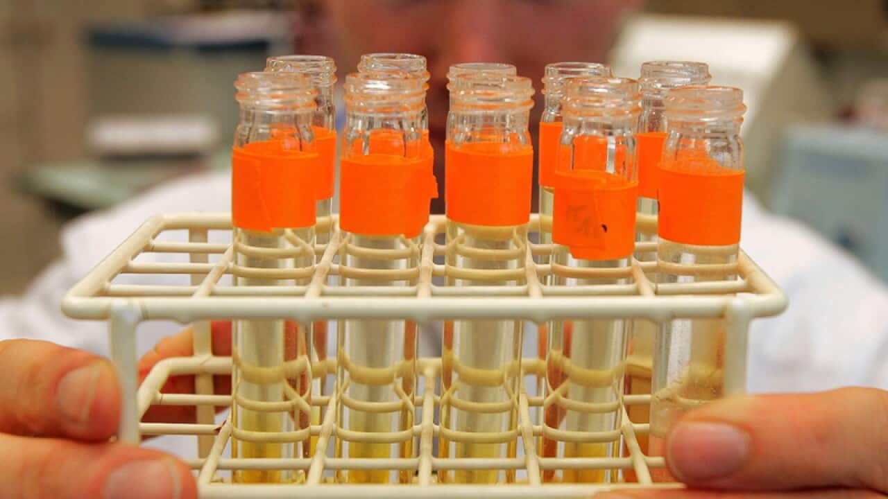 Urine samples are prepared for testing