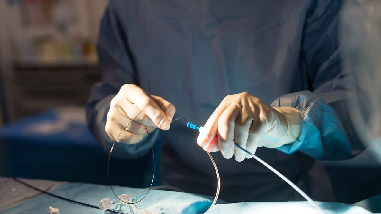 Emergency treatment of an ischemic stroke through thrombectomy (Getty).