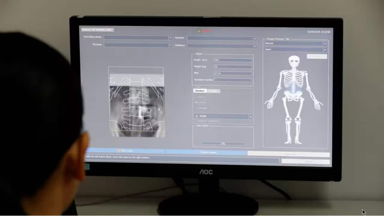 Australians over 50 years old are being warned to take care of their bones, after a new report has found over two in three Australians from that age bracket live with poor bone health. Credit: Getty Images