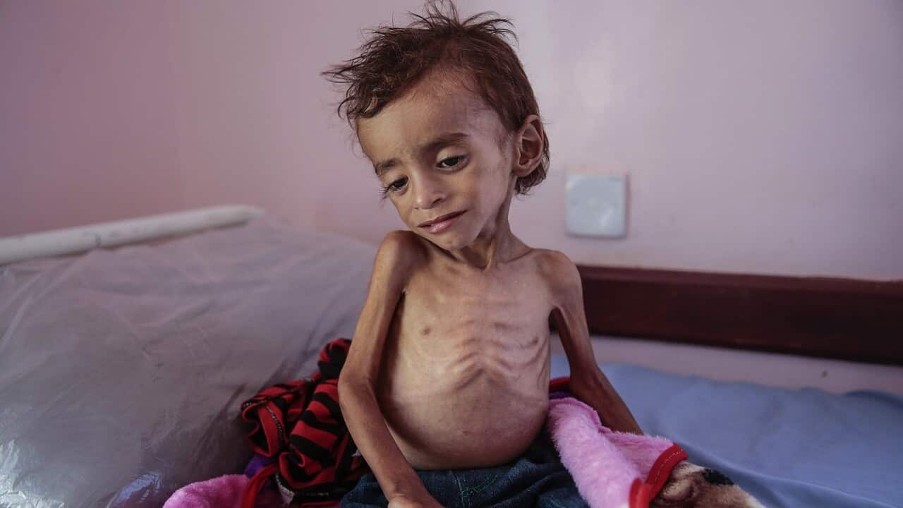 A malnourished boy sits on a hospital bed at the Aslam Health Centre.