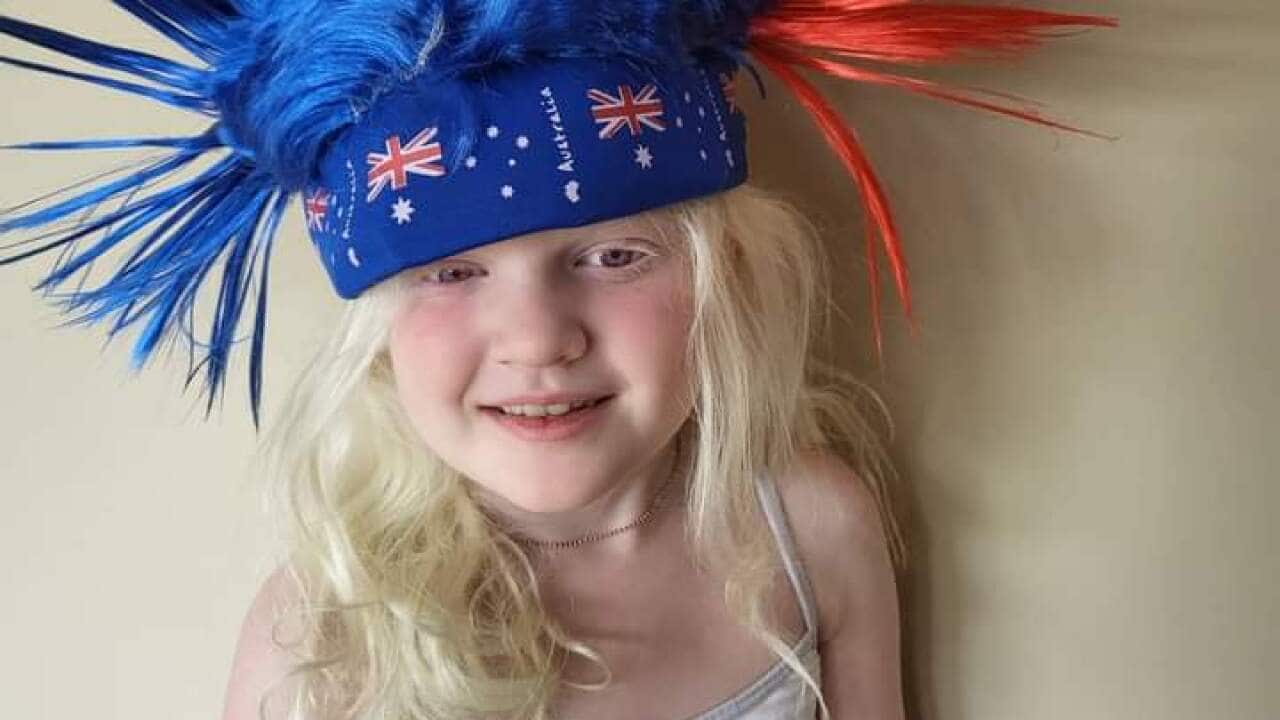 Mary Rose Succar is learning to live with albinism