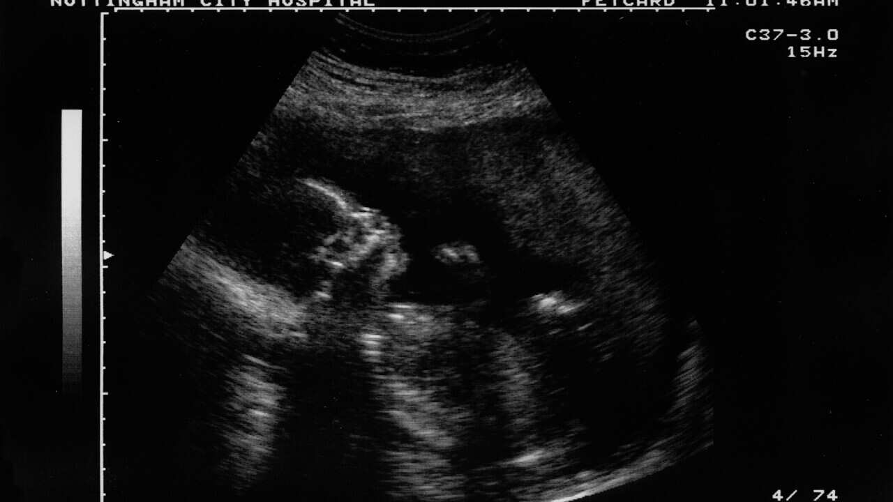 Ultrasound (illustration photo)