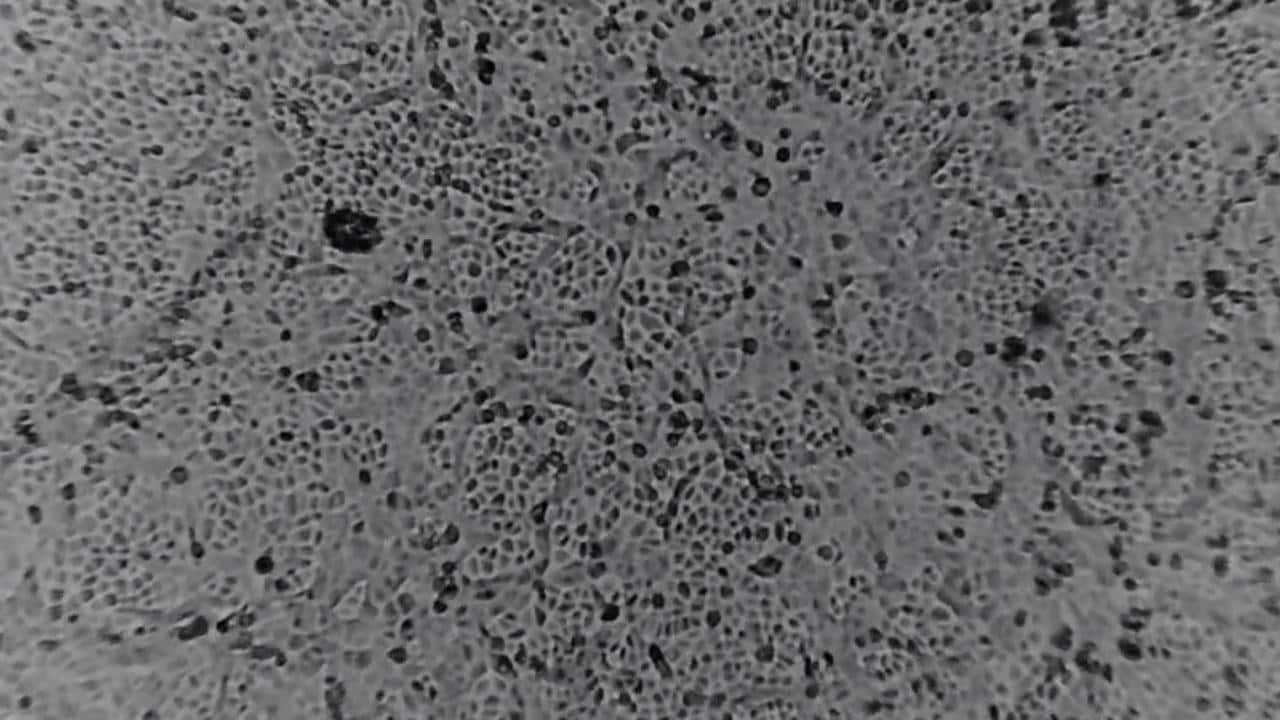 corona virus will stick around for a while