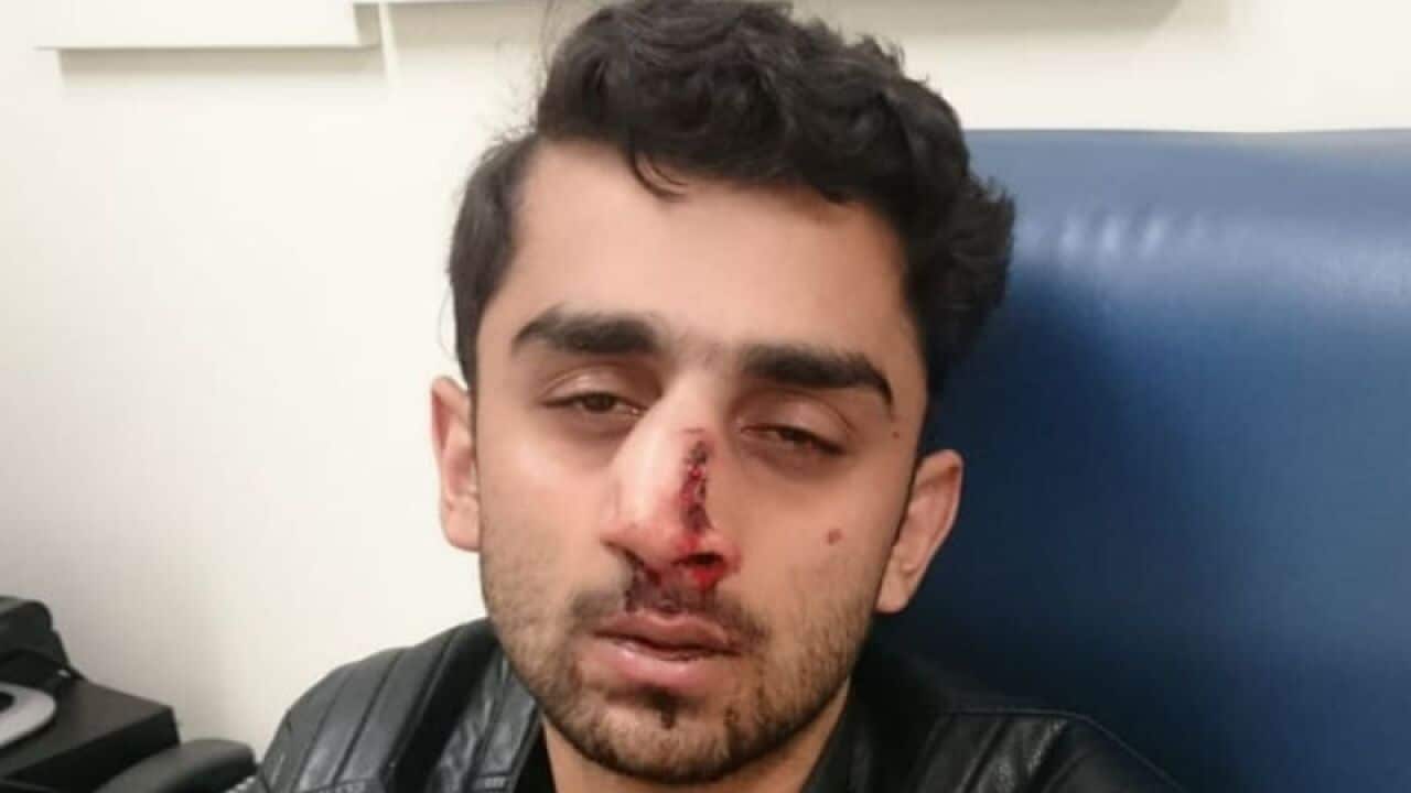 Abdullah Qaiser after he was attacked on campus.