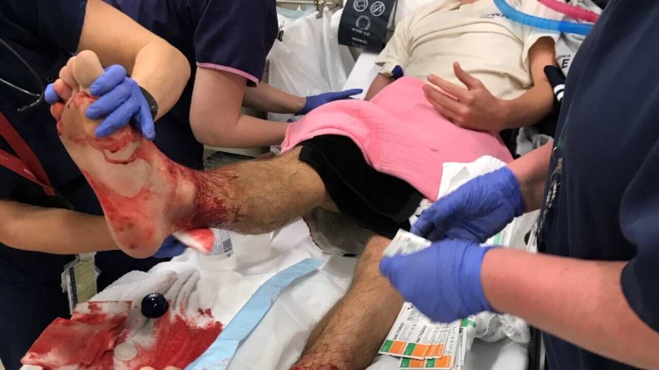 A supplied image obtained on August 6, 2017 of 16-year-old Sam Kanizay in a Melbourne Hospital after sustaining suspected bites from 'tiny marine creatures'