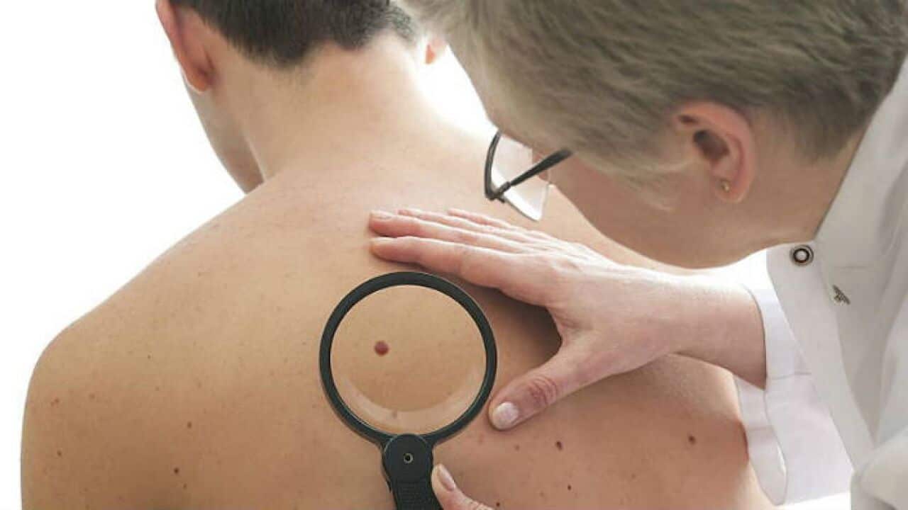 Melanoma