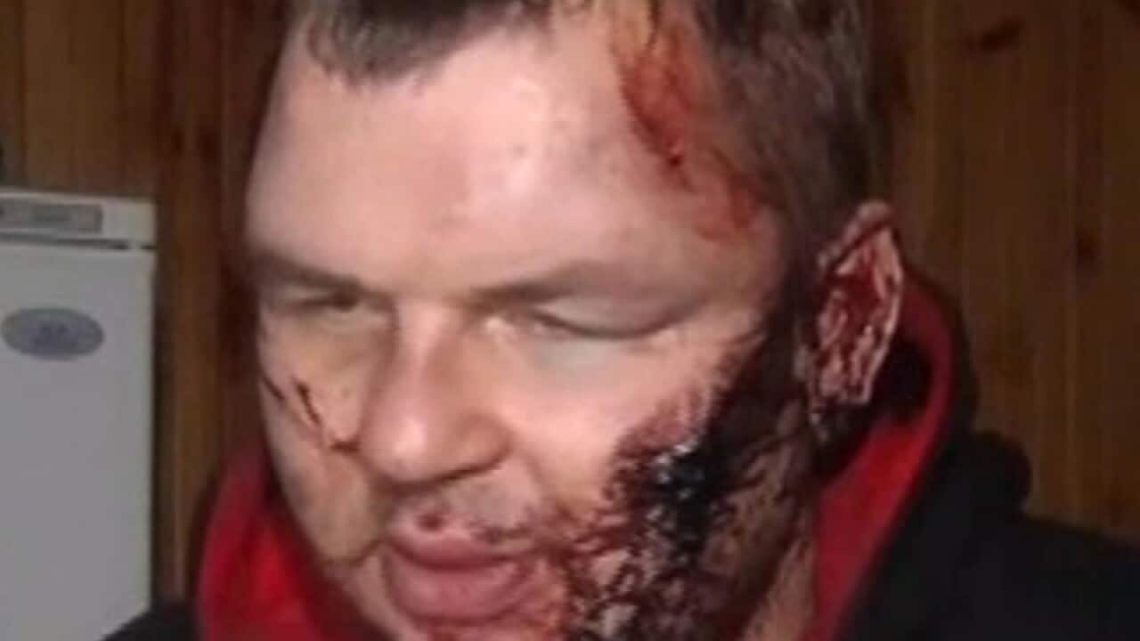 Ukranian opposition activist Dmytro Bulatov