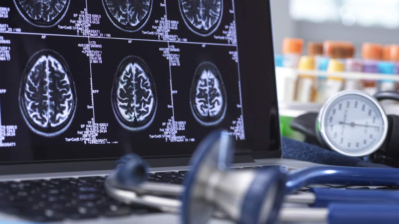 Close up of stethoscope and brain scan on a computer screen.
