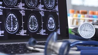 Close up of stethoscope and brain scan on a computer screen.