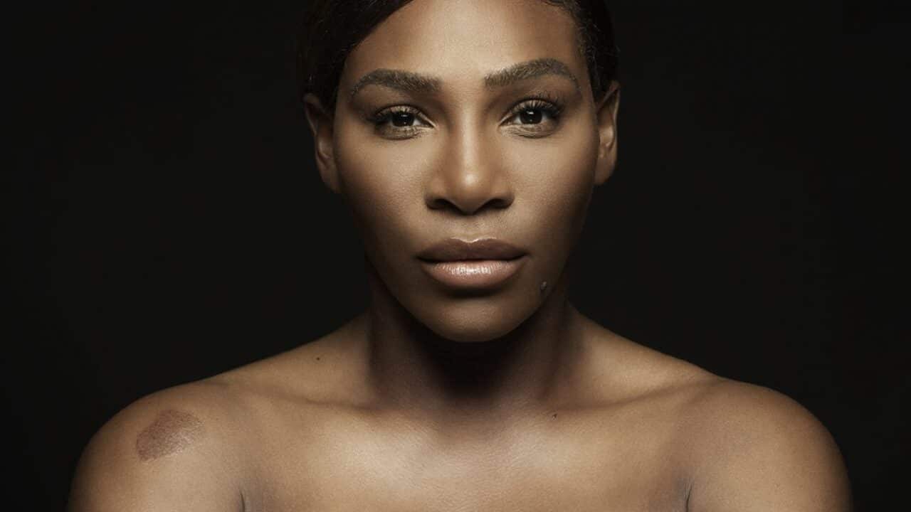 Serena Williams