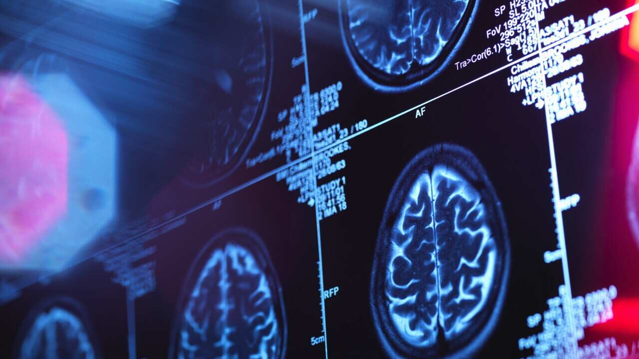 Human brain scan in a neurology clinic