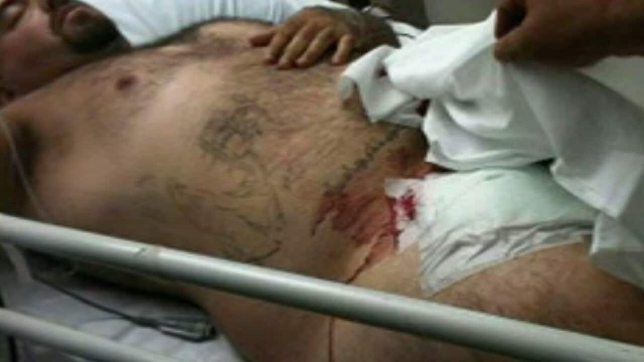 shooting_sydney_120207_B_SBS_470940328