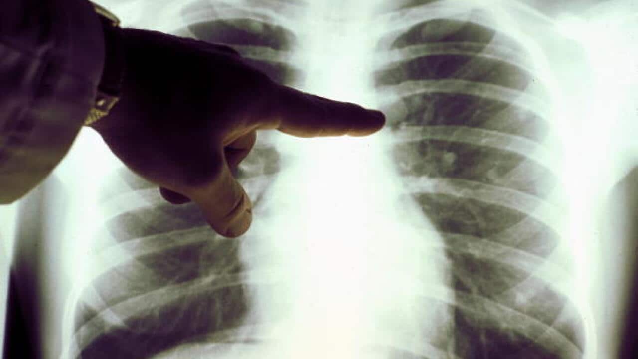 Cancer Images