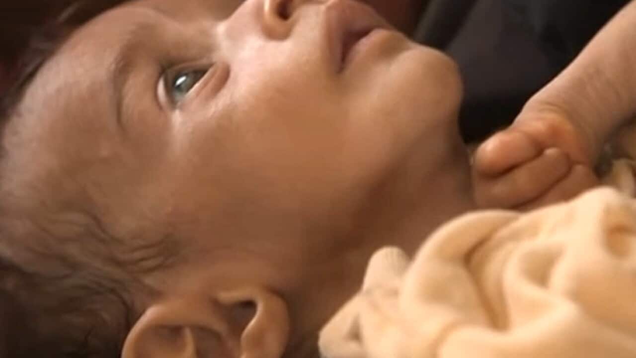 yemen_famine_120720_bbc_829671341
