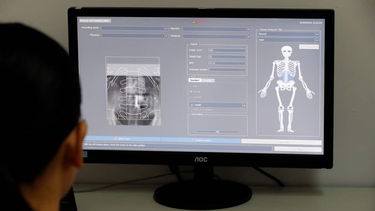 Medix 90 a tool for routine osteoporosis and fracture risk assessment. Cardiology hospital. Ho Chi Minh City. Vietnam.