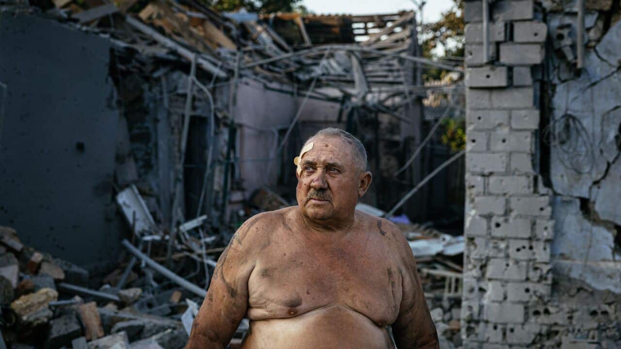 UKRAINE-RUSSIA-CONFLICT-WAR