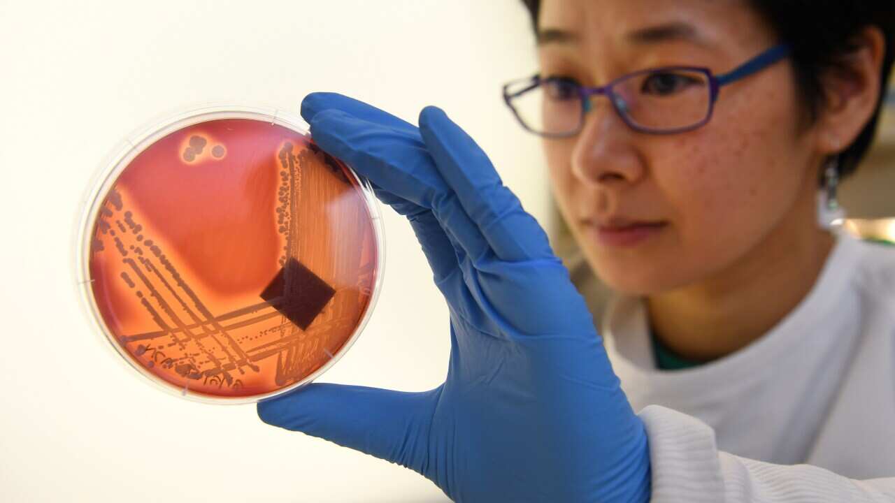A woman holds an agar plate.