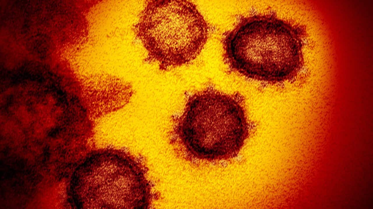 Novel Coronavirus SARS-CoV-2 This transmission electron microscope image shows SARS-CoV-2also known as 2019-nCoV,