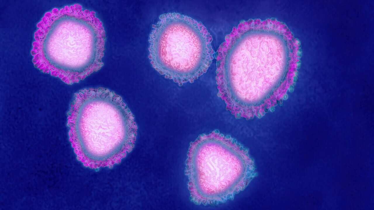 The human coronavirus causes respiratory infections (colds), and gastroenteritis. Image made from a transmission electron microscopy view. Approximate viral diameter: 80 to 160 nm. (Photo by: Cavallini James/BSIP/Universal Images Group via Getty Images)