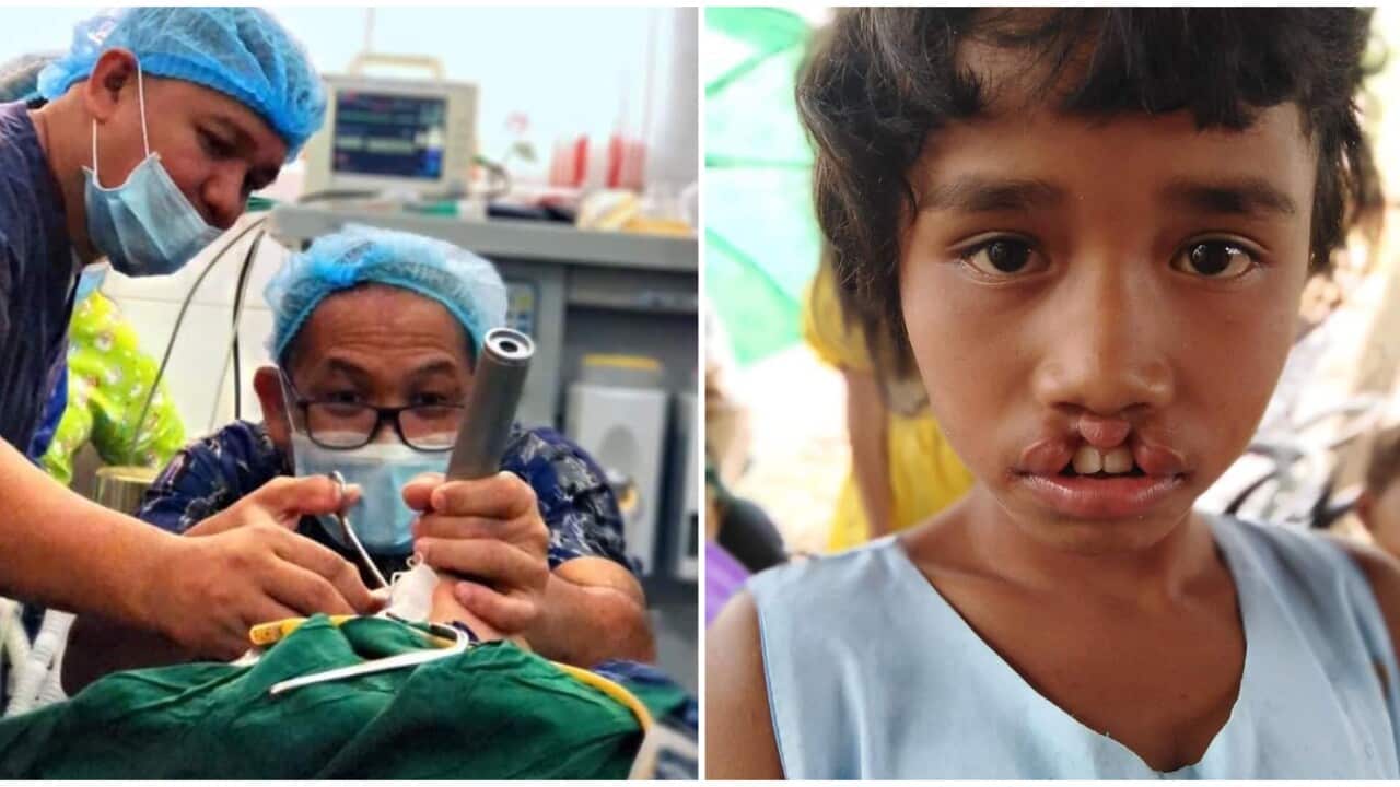 Share me a dream, surgical mission, cleft lip, cleft palate