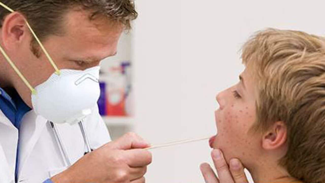 Measles