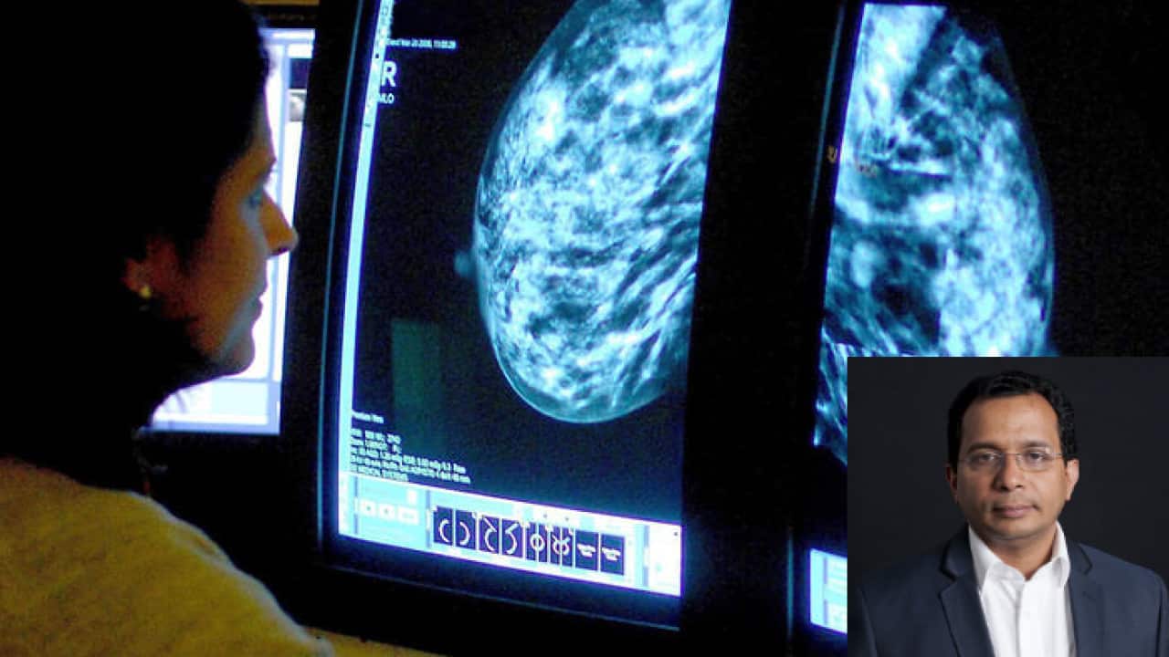 Breast Cancer