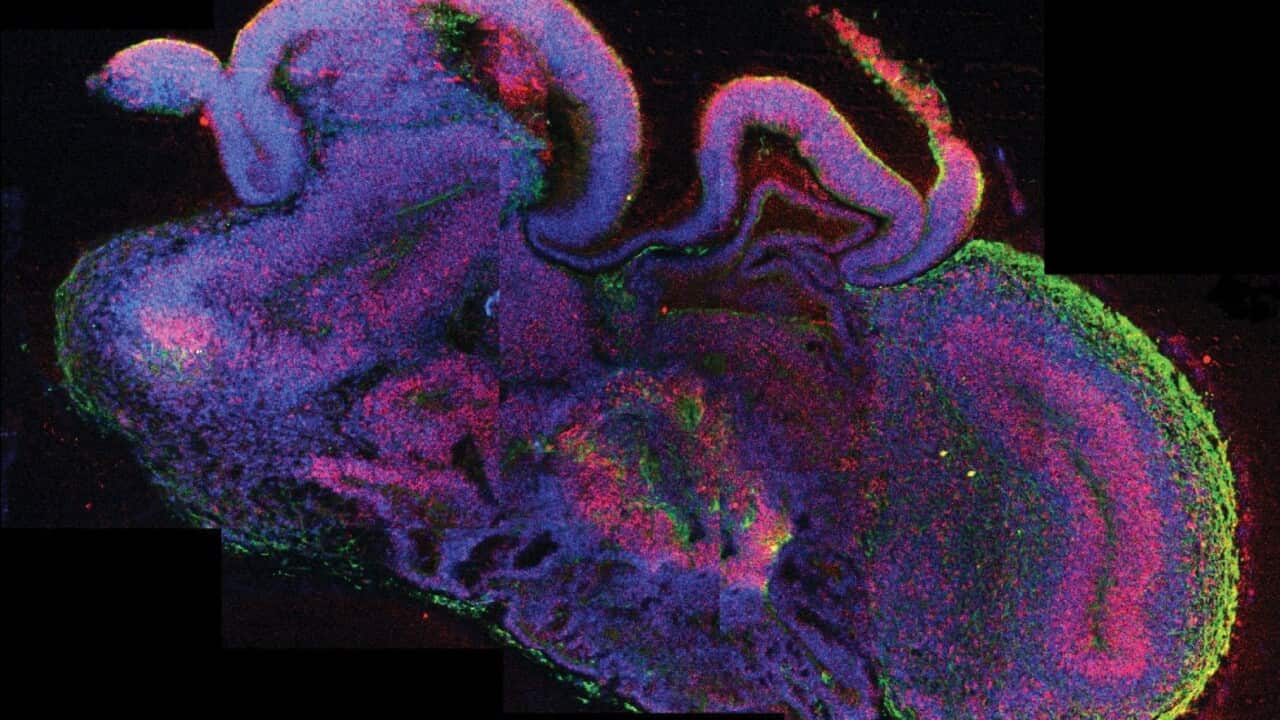Cross-section of a human brain. (AAP)