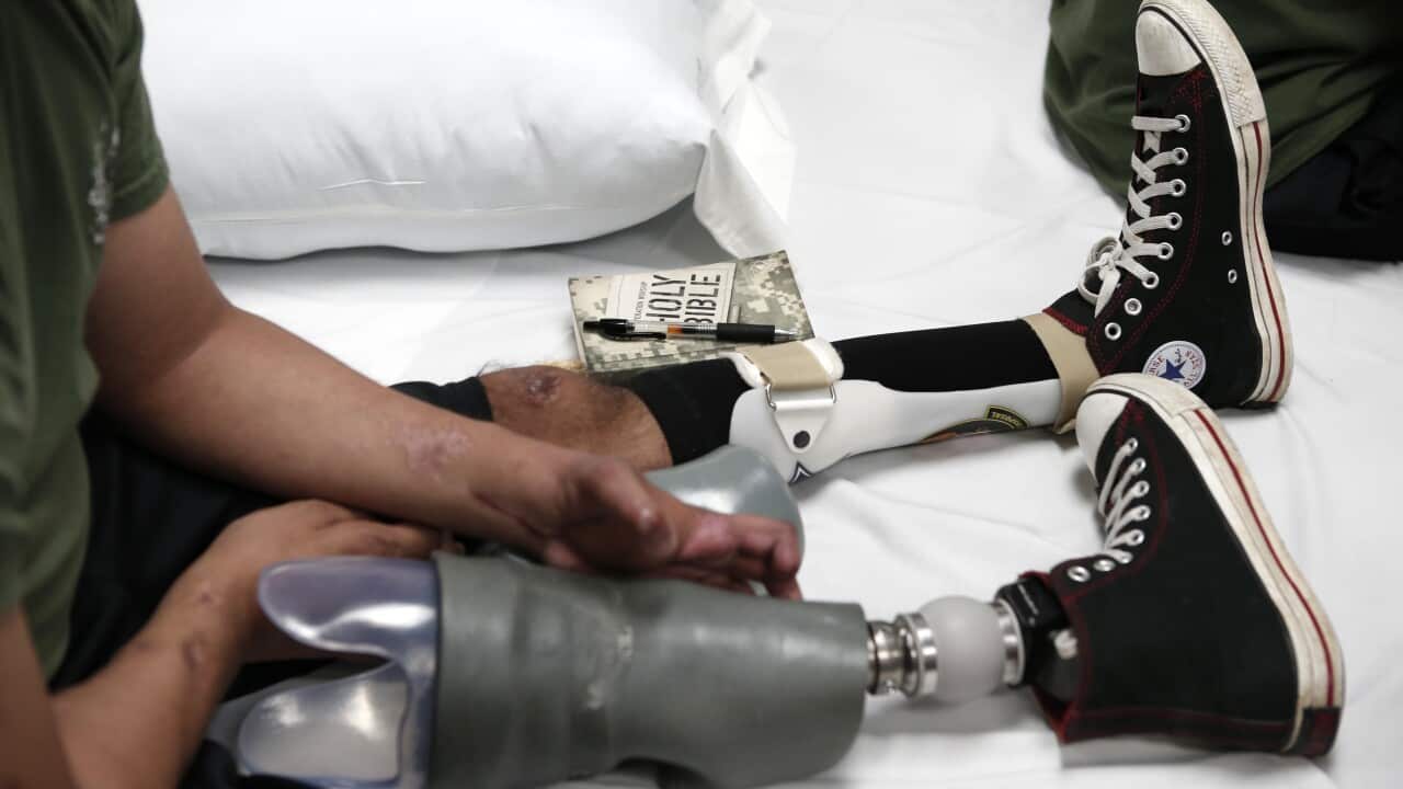 A wounded soldier with prosthetic legs keeps a Bible at his side at a rehabilitation center at Walter Reed National Military Medical Center in Bethesda, Maryland.