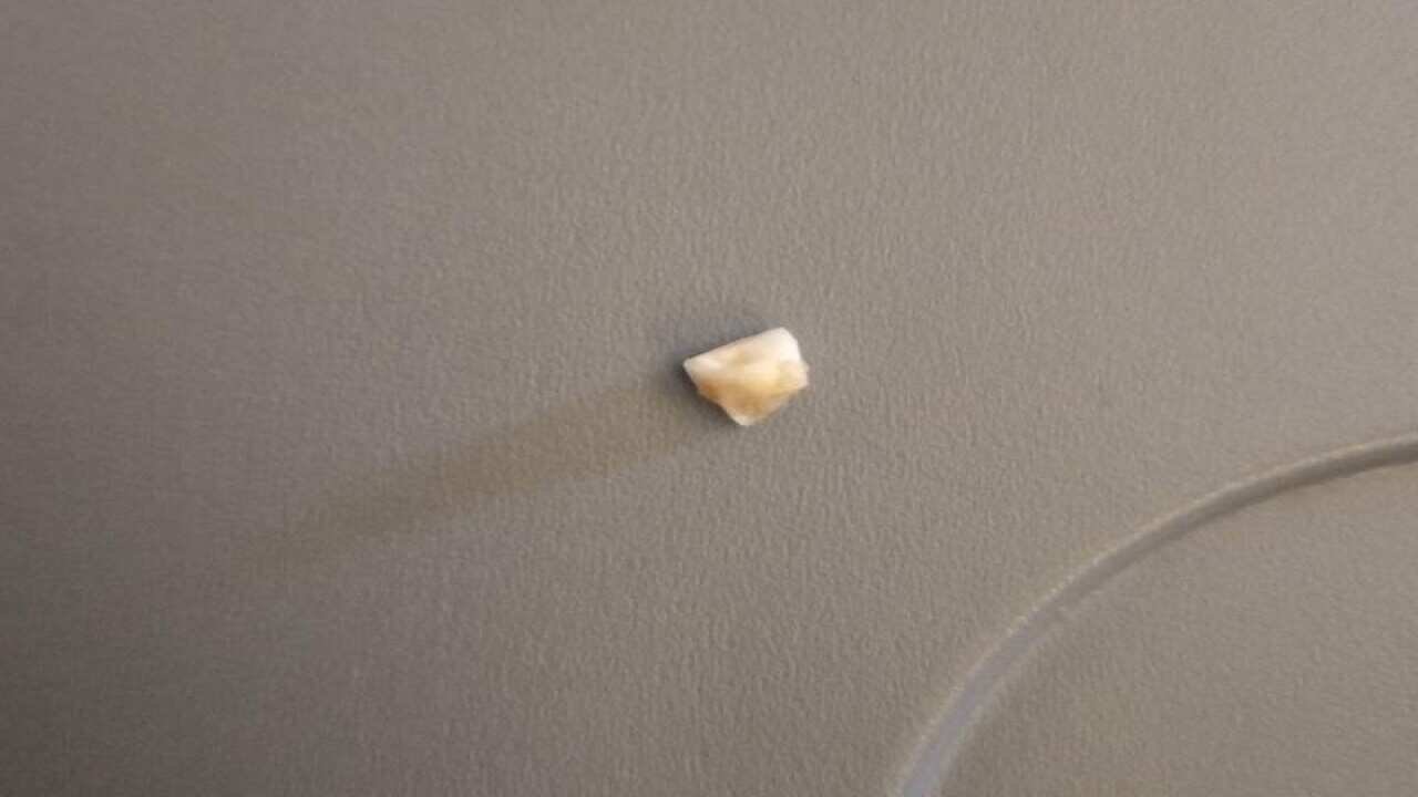 A human tooth on an airline tray.