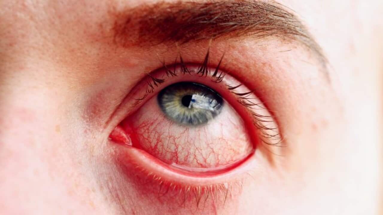 Extreme Close-Up Of Person Stretching Eye