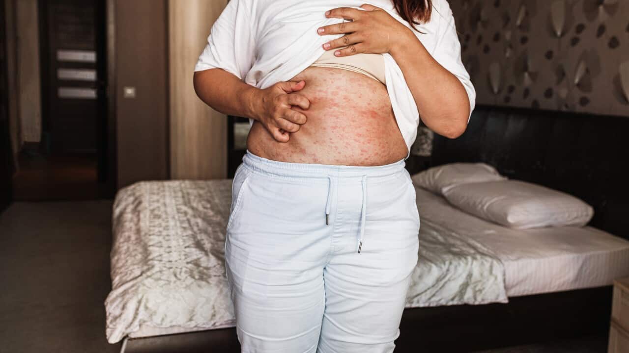 Plus-size woman standing in bedroom and scratching exposed stomach with severe case of skin fungus