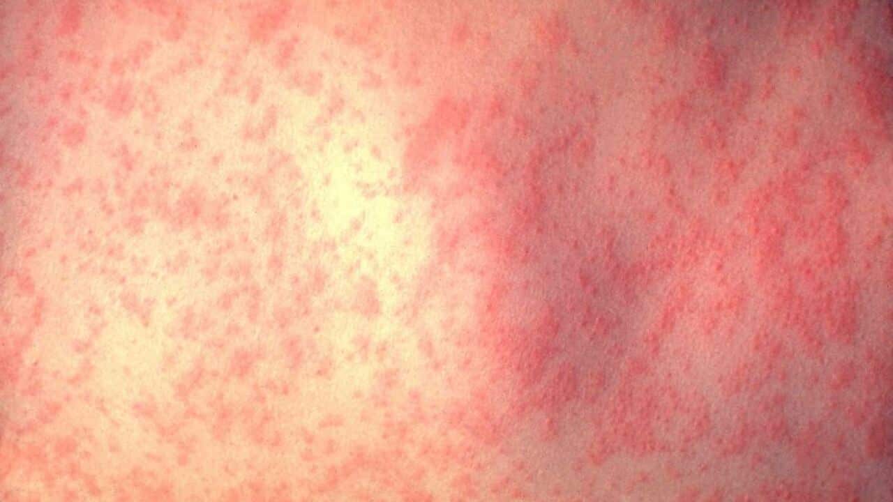 Centres for Disease Control