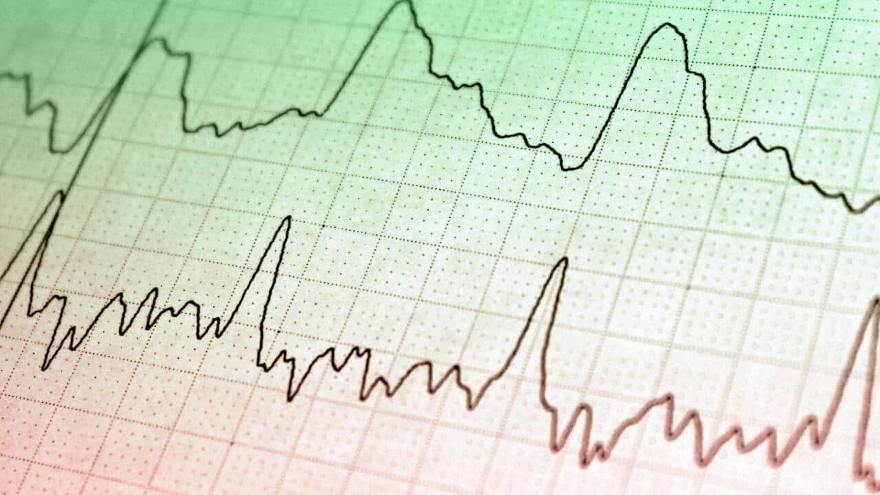 Graphs