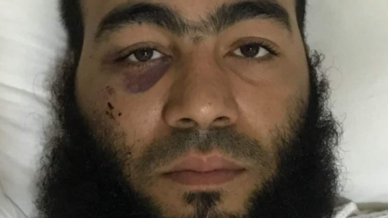 In this Saturday, Oct. 8, 2016 photo released by Kuwait Ministry of Interiors, Ibrahim Sulaiman from Egypt lays in a hospital bed.