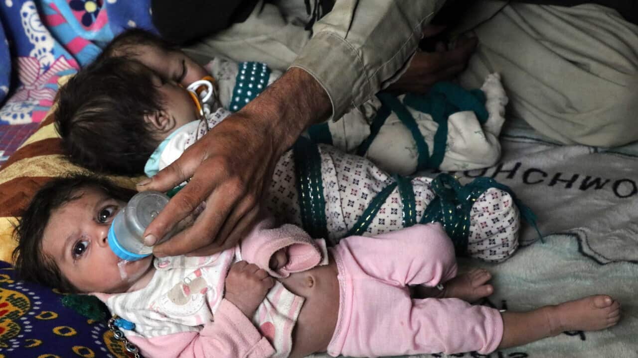 AFGHANISTAN CRISIS HUNGER AND MALNUTRITION