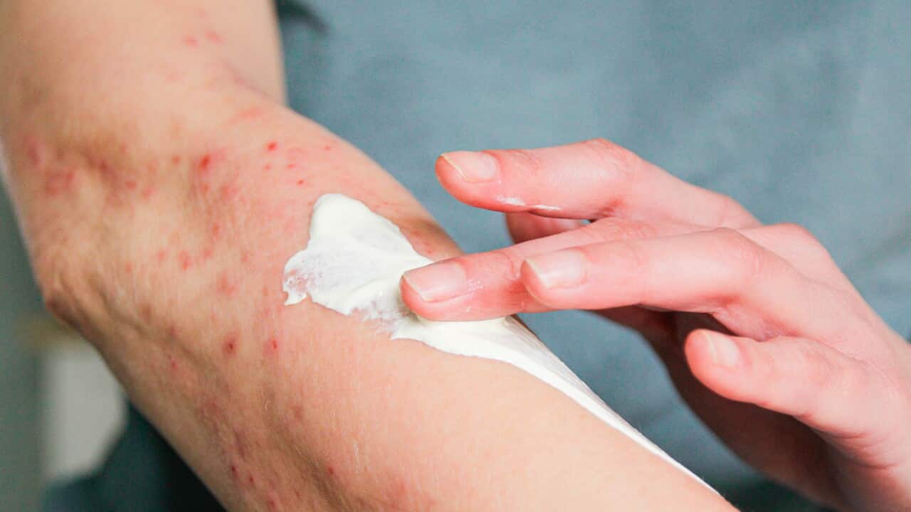 Atopic eczema