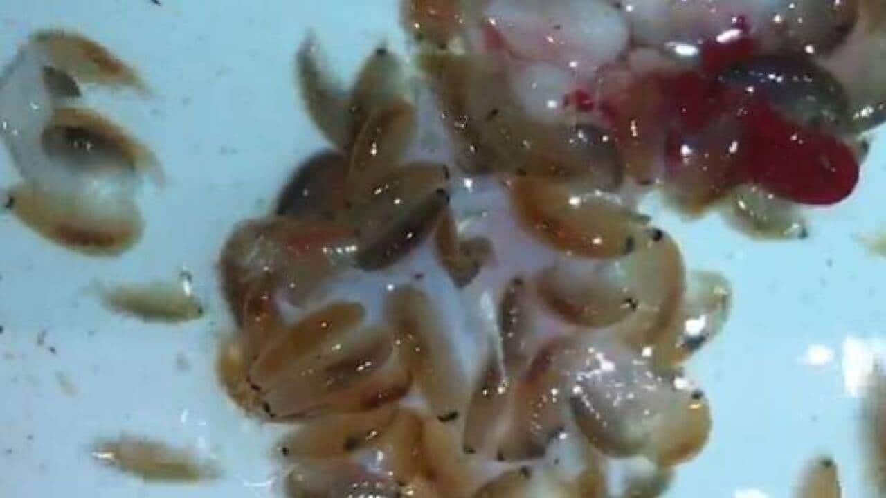 Are 'sea fleas' to blame for bloody bites on Australian teen's legs?