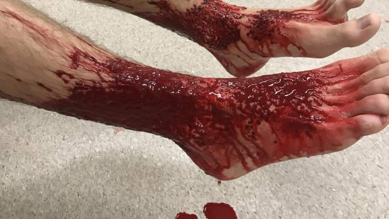 Sam Kanizay in a Melbourne Hospital