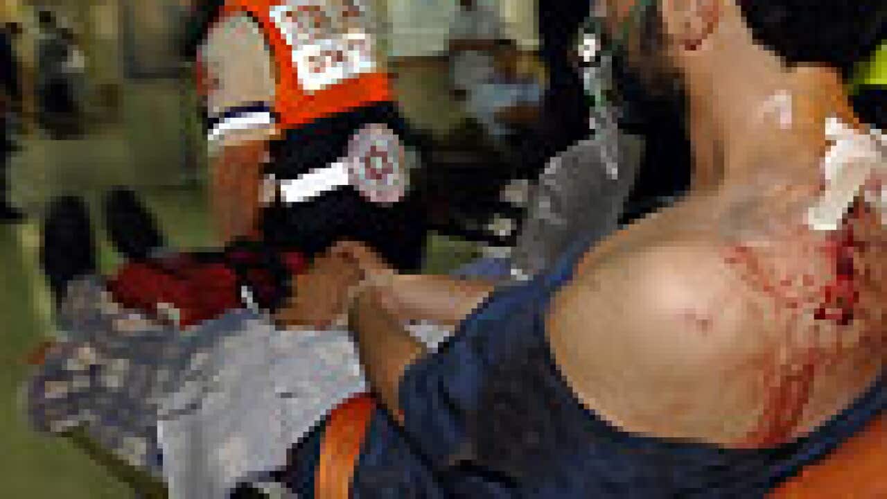 israel_flotilla_raid_injuredactivist_100602_afp_getty_B_207837521