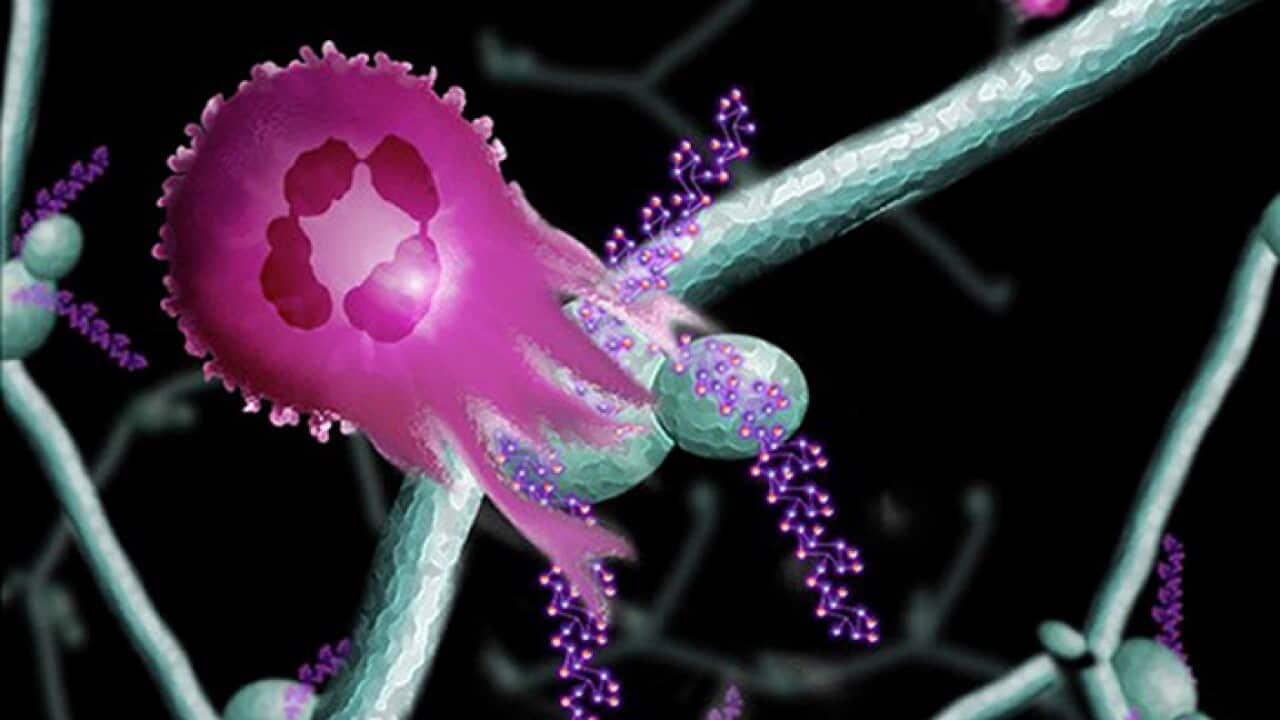 Undated artist impression of a neutrophil attacking a cancer cell