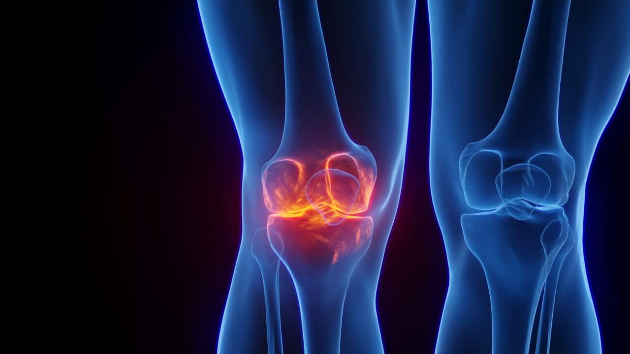 Inflamed knee, illustration