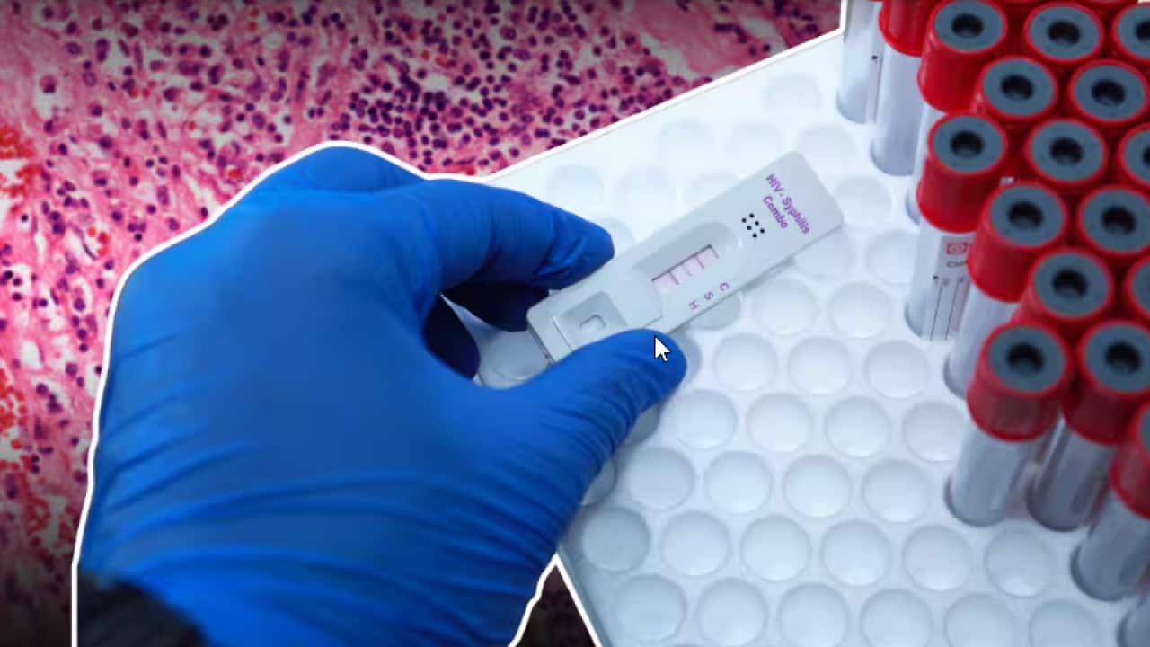 Increases in some STIs have led experts to call for better community-focused and tailored messaging around prevention, testing and treatment..png