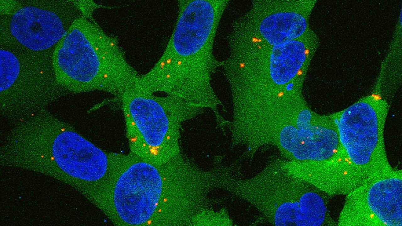 Image for read more article ''