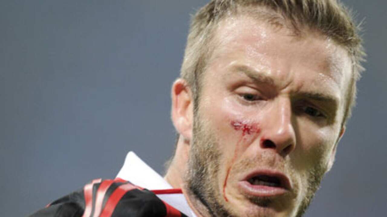 beckham_headshot_injured_100316_B_getty_430357555