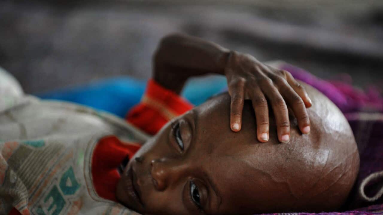 famine_africa_child_b_afp_110704_1113508450