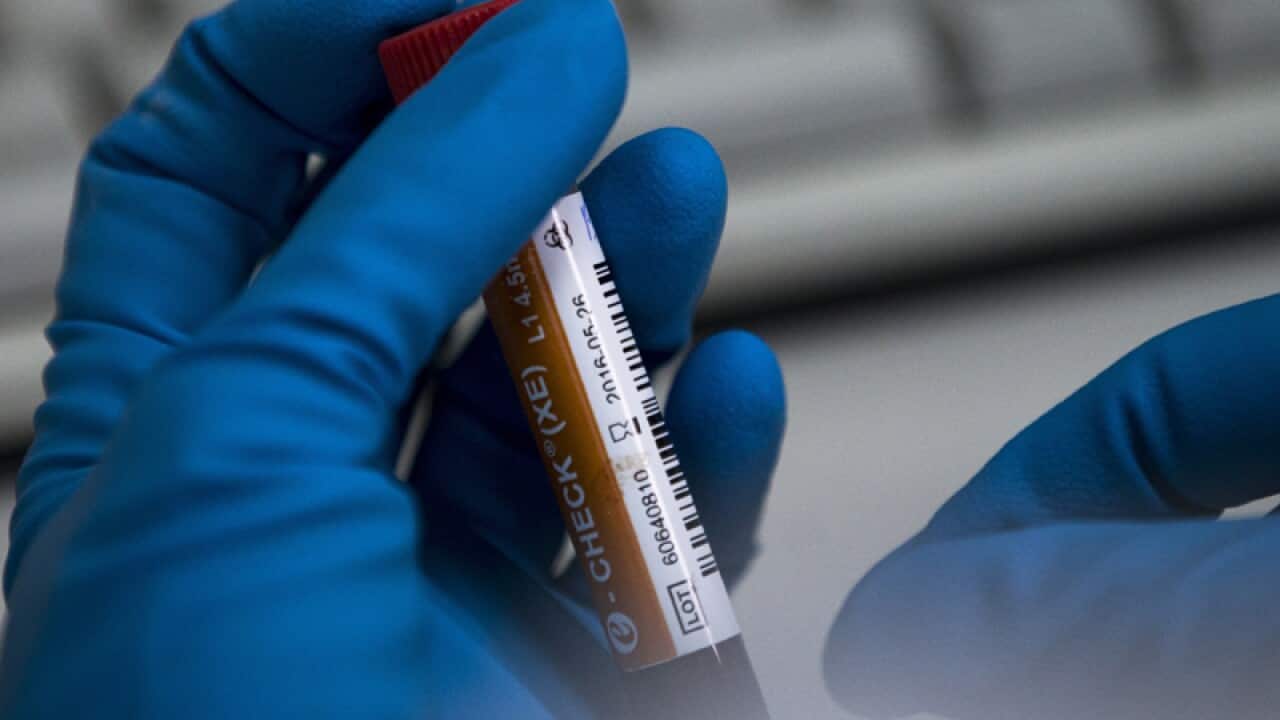 An employee of Russia's national drug-testing laboratory hold a vial