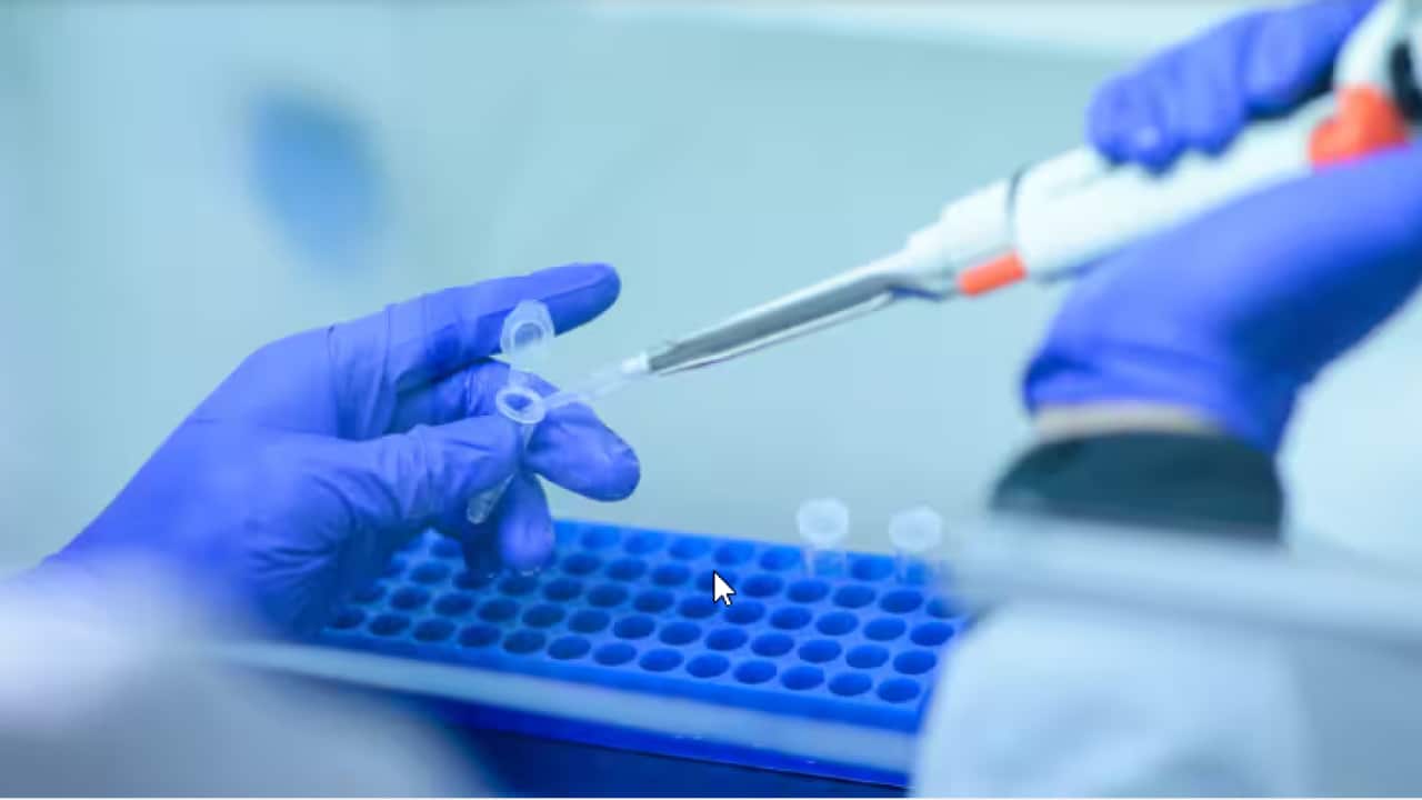 The findings of a new study could improve understanding of what drives severe COVID-19..png