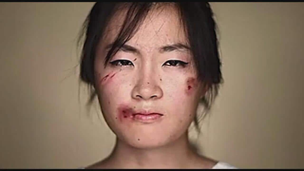 A model from a Chinese anti-domestic violence campaign. (Supplied)